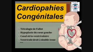 Cardiopathie congénitale cyanogène  fréquentes chez bébé malformation cardiaque Cours Cardiologie [upl. by Ferdinand]