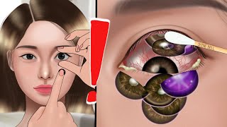 ASMR Removal of many contact lenses from the eye👁 Animation oshi no ko [upl. by Adnohsad]