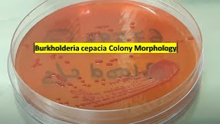 Burkholderia cepacia growth on Macconkey agar [upl. by Naujyt]