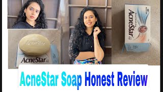 Acnestar Soap Honest Review including bloopers 😂 [upl. by Oznofla]