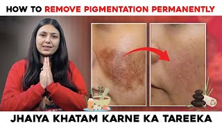 How to remove Pigmentation Permanently  Best Home Remedies  Skin Care Tips  Upasana Ki Duniya [upl. by Adnocahs]