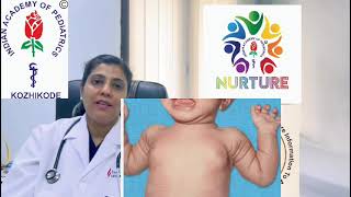 Gynaecomastia  ആൺകുട്ടികളിലെ സ്തന വളർച്ച അറിയേണ്ടതെല്ലാം [upl. by Eachelle274]