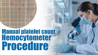 Manual platelet count  hemocytometer Procedure  Calculation  interpretation [upl. by Tallula]