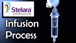 Stelara Infusion Process Ulcerative Colitis Treatment [upl. by Loni]