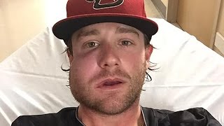 Diamondbacks Pitcher Takes 115 MPH Hit to His Face [upl. by Daggett]