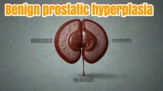 Benign prostatic hyperplasia BPH [upl. by Felicio]