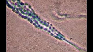 Penicillium cheresanum showing single celled conidia [upl. by Emmaline]