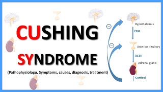 Cushing SyndromeCauses Clinical features Diagnosis Treatment Pathophysiology [upl. by Bilac]