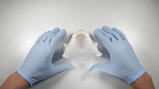 How To Resolve A Bony Mylohyoid Sequestrum  OnlineExodontiacom [upl. by Ylekalb]