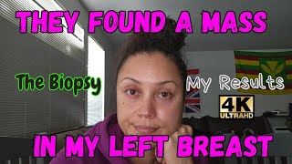 They Found A Mass In My Left Breast  My Biopsy  The Results  Biopsy Mammogram BreastHealth [upl. by Bunder]