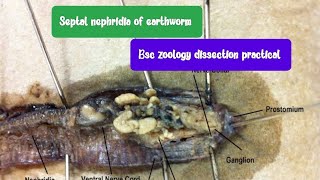 Septal nephridia of earthworm dissection BSc zoology 5 semester [upl. by Eimam228]