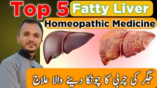 Fatty Liver Treatment  Fatty Liver Homeopathic Medicine  Top 5 Homeopathic Medicine [upl. by Ardnauqal]