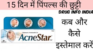 Acnestar gel review in Hindi [upl. by Danae898]