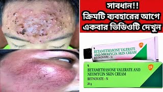 Betnovate n skin cream  বেটনোভেট এন ক্রিম এর কাজ কি ত্বক ফর্সাকারী ক্রিম  Betnovate N Cream [upl. by Artus]