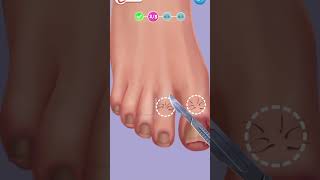 shorts ASMR Ingrown Toenail Removal asmr games animation [upl. by Stannwood]