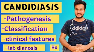 Candidiasis microbiologypathogenesislabdiagnosisTreatment [upl. by Jori]