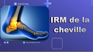 IRM de la cheville Bonne Pratique [upl. by Indihar]