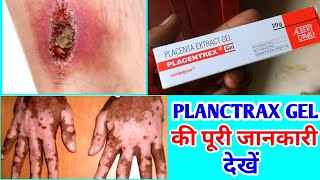 PLACENTREX GEL की पूरी जानकारी देखें फ़ायदे और नुकसान जानें  PLACENTREX GEL USES IN HINDI [upl. by Enael18]