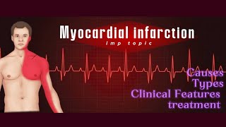 Myocardial infarction USMLE step 1usmle physiology medicines [upl. by Raasch]