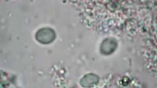 Trichomonas  Biologie Mostaganem [upl. by Tinor]