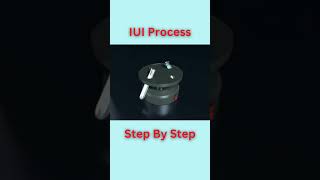 Revealing the Ultimate IUI Process infertility pregnancy doctor [upl. by Hernandez]