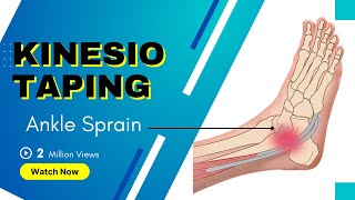 How to treat an Ankle Inversion Sprain  Kinesiology Taping to stabilise ligaments [upl. by Pierro]