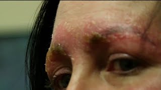 Woman shares dangers of eyebrow microblading [upl. by Theobald]