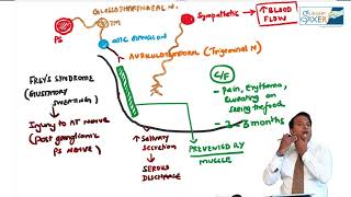 10 minute series FREYs Syndrome [upl. by Baskett]