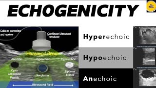 Explain Echogenicity  hyperechoic hypoechoic anechoic [upl. by Durwin325]