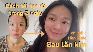 ĐIỀU NHẤT ĐỊNH PHẢI LÀM  trong 3 ngày Sau PHI KIM chị gái hàn quốc chia sẻ [upl. by Dosi]