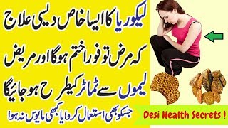 Likoria ka ilaj in urdu  Likoria Treatment at Home [upl. by Ttennaj]