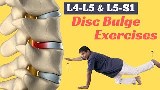 6 Best Diffuse Disc Bulge at L4L5 and L5S1 Treatment Exercises [upl. by Attezi]