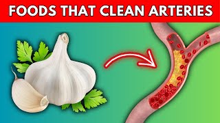 Top 10 Foods that Unclog Arteries Naturally and Prevent Heart Attack Pure Wellness [upl. by Ymmaj607]