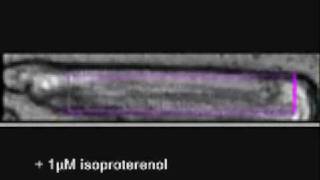 cardiac myocyte contractility [upl. by Johnstone]