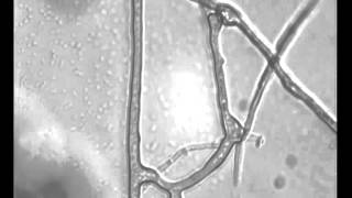 Anastomosis in mycorrhizal fungi [upl. by Netsirc]