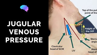 Measuring Jugular Venous Pressure JVP  OSCE Guide Clip  UKMLA  CPSA [upl. by Ecyac]