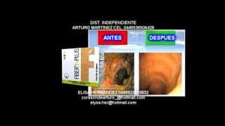 FIBERN PLUS LIMPIEZA INTESTINAL 1er PASO PARA BAJAR DE PESO [upl. by Boone]