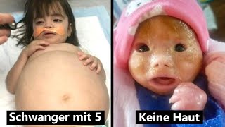 8 echte Kinder mit einem unglaublichen Schicksal [upl. by Heather]