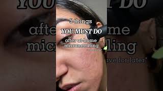 5 things you MUST do for microneedling aftercare acne acnescars microneedling [upl. by Ekrub447]