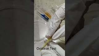 Oxidase test [upl. by Kcirdaed659]