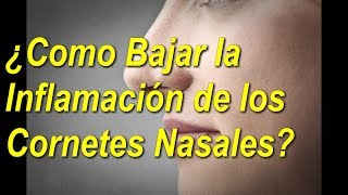 5 👀TRATAMIENTOS NATURALES para los 👃CORNETES de la NARIZ  Al 👉FINAL QUEDARAS 😲SORPRENDIDO [upl. by Eenwahs]