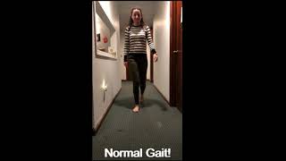 Antalgic Gait Demonstration [upl. by Tebazile]