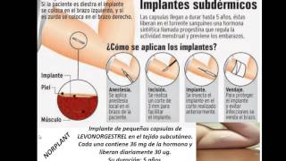 Anticonceptivos hormonales [upl. by Ardnuyek]