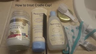 How to get rid of Cradle Cap [upl. by Annaitsirk]