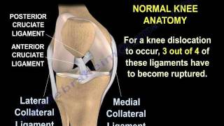 Knee Dislocations  Everything You Need To Know  Dr Nabil Ebraheim [upl. by Llerred]