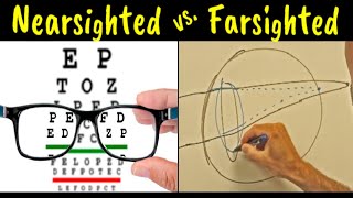 Myopia vs Hyperopia vs Presbyopia  Difference Explained [upl. by Ihcelek]