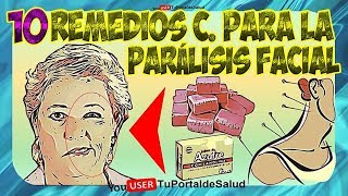 Como Tratar la Paralisis Facial Remedios Caseros  10 Remedios Naturales Para la Parálisis Facial🌻✅ [upl. by Natica]