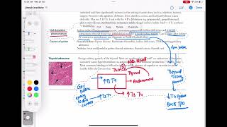 causes of goiter endocrinology 47  First Aid USMLE Step 1 in UrduHindi [upl. by Elocan]