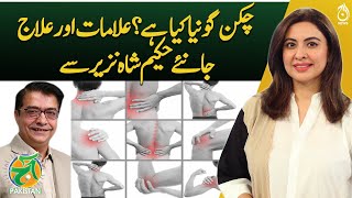 Chikungunya Fever amp Joint Pain  Remedies By Hakeem Shah Nazir  Aaj Pakistan [upl. by Larkins]