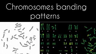 Chromosomes banding patterns [upl. by Werbel]